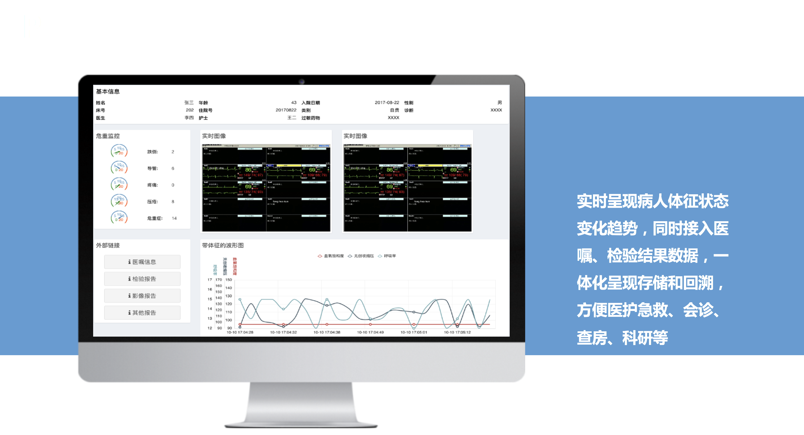 UniVue中央監護系統